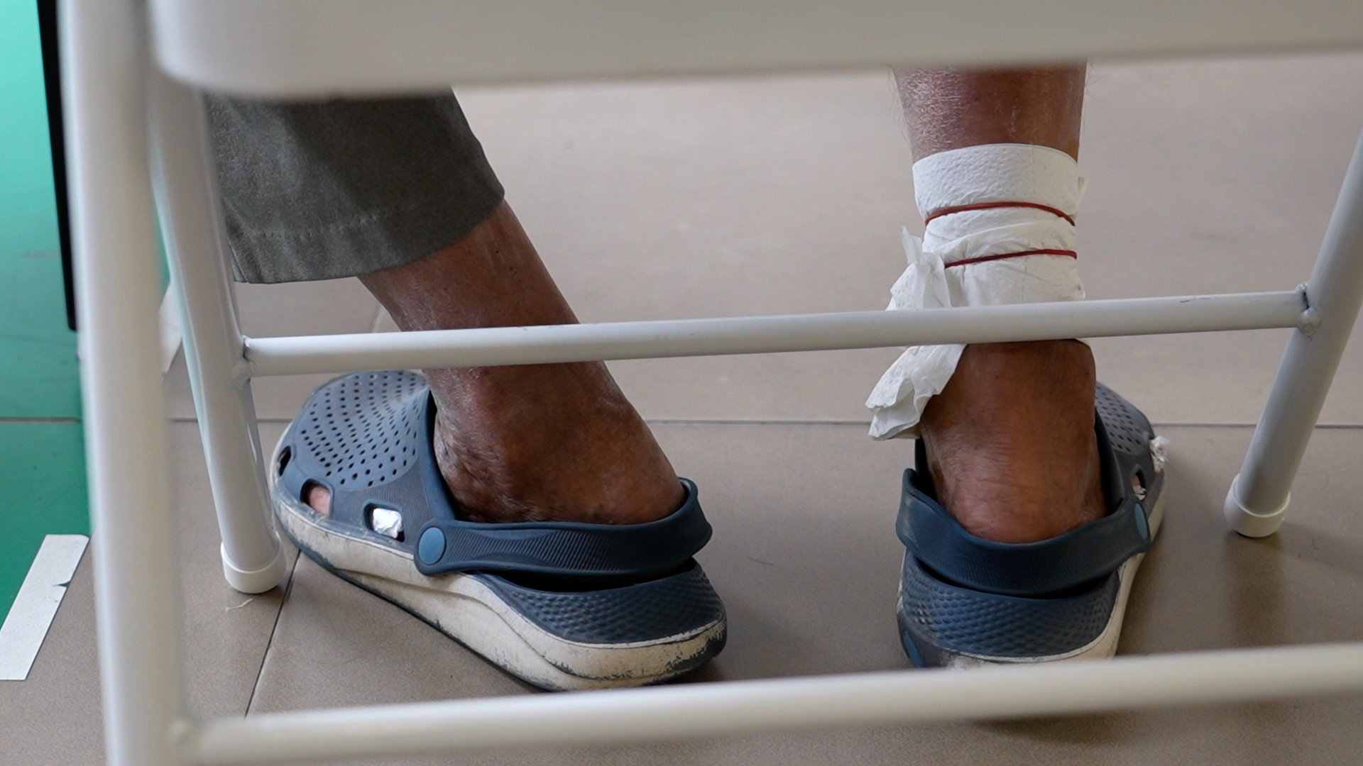 Beyond the Missing Roof